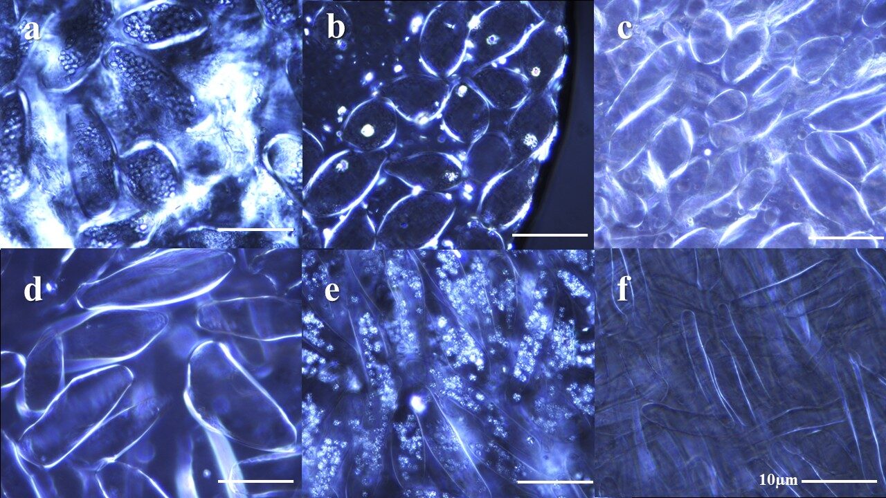 Higher magnification view of eleutherocytes